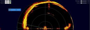 Sonar de secção transversal para inspeção subaquática com ROV